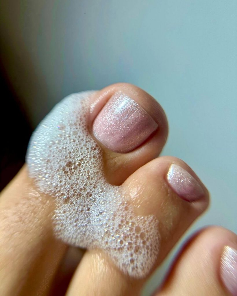 Callosités des pieds