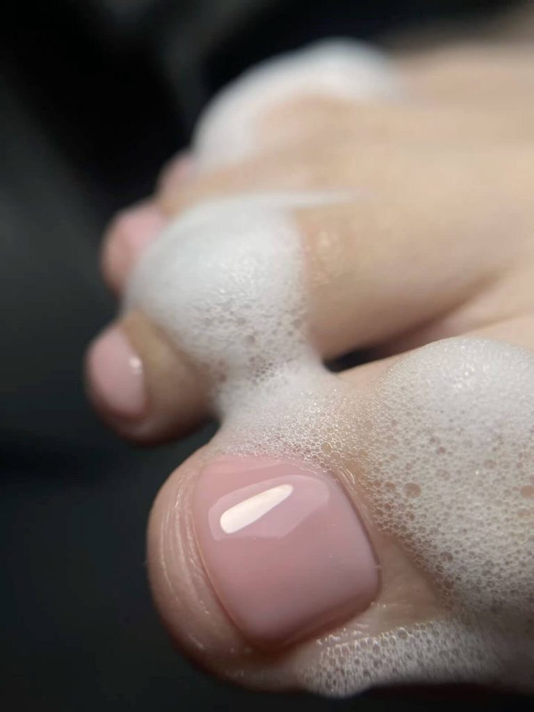 Callosités des pieds